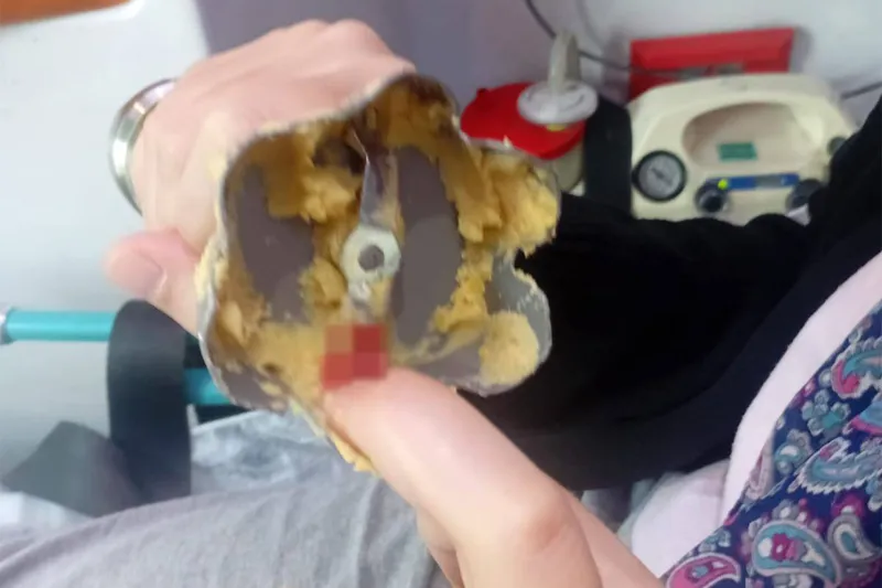 Batman’da parmağı blendere sıkışan vatandaşa acil müdahale